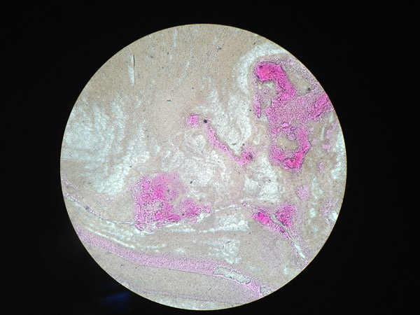 Bacteria E. Coli con fuscina